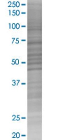 Rad23b 293t cell transient overexpr ession lysate (denatured) 100 µl