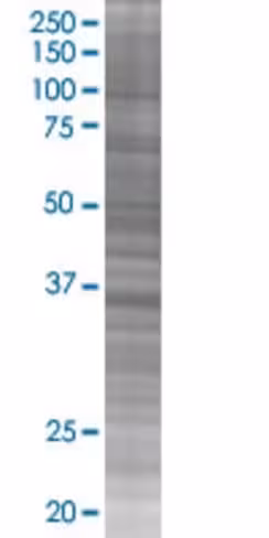 Rad51 293t cell transient overexpre ssion lysate (denatured) 100 µl