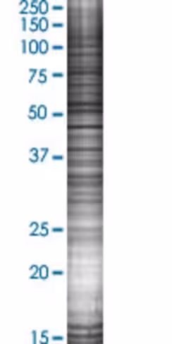 Rad51c 293t cell transient overexpr ession lysate (denatured) 100 µl