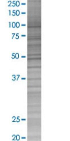 Rage 293t cell transient overexpres sion lysate (denatured) 100 µl