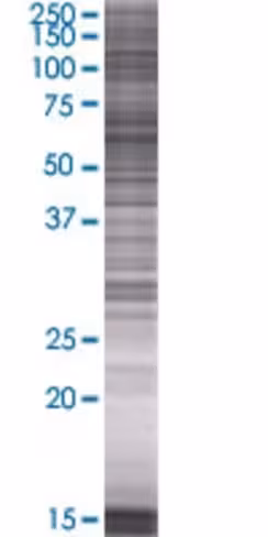 Rag2 293t cell transient overexpres sion lysate (denatured) 100 µl