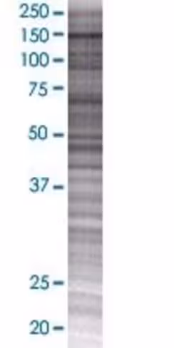 Ralgds 293t cell transient overexpr ession lysate (denatured) 100 µl