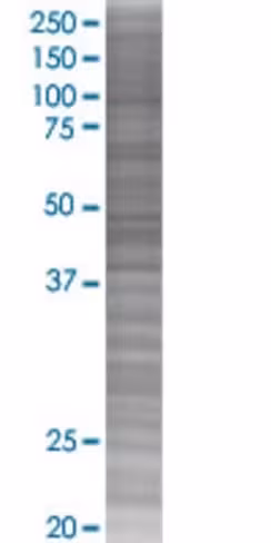 Rarb 293t cell transient overexpres sion lysate (denatured) 100 µl