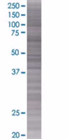 Rars 293t cell transient overexpres sion lysate (denatured) 100 µl