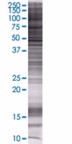 Rarres2 293t cell transient overexp ression lysate (denatured) 100 µl