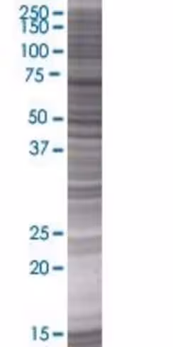 Rbbp5 293t cell transient overexpre ssion lysate (denatured) 100 µl