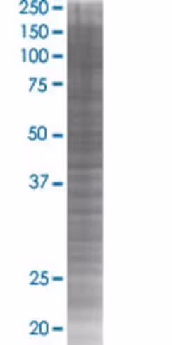 Rbms2 293t cell transient overexpre ssion lysate (denatured) 100 µl