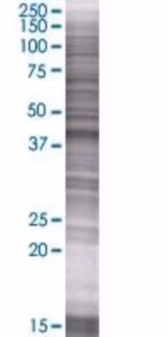 Rbmy1a1 293t cell transient overexp ression lysate (denatured) 100 µl