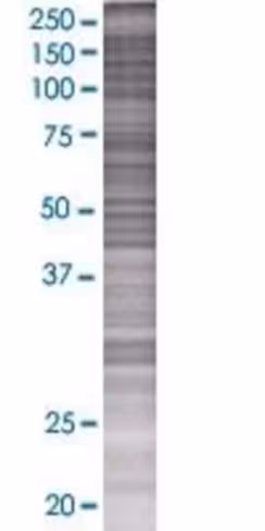 Rcn2 293t cell transient overexpres sion lysate (denatured) 100 µl
