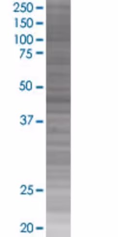 Rcn2 293t cell transient overexpres sion lysate (denatured) 100 µl