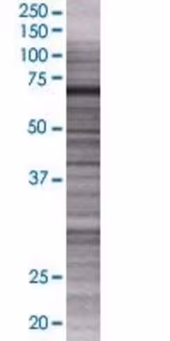 Recql 293t cell transient overexpre ssion lysate (denatured) 100 µl