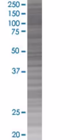 Ret 293t cell transient overexpress ion lysate (denatured) 100 µl