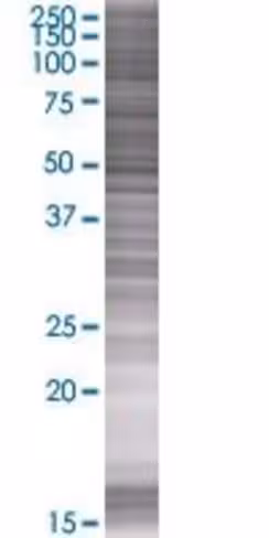 Pgcp 293t cell transient overexpres sion lysate (denatured) 100 µl