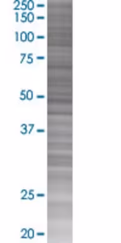 Pgcp 293t cell transient overexpres sion lysate (denatured) 100 µl