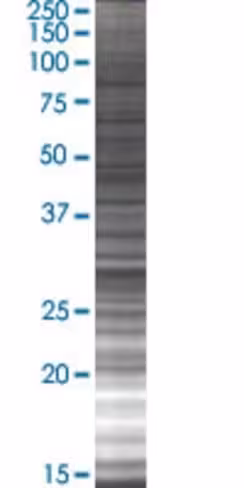 Ppie 293t cell transient overexpres sion lysate (denatured) 100 µl