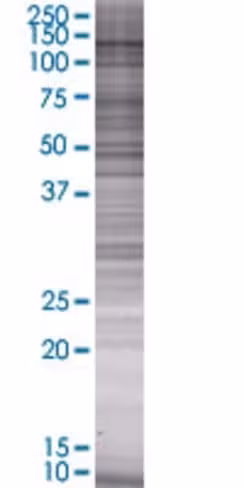 Pitrm1 293t cell transient overexpr ession lysate (denatured) 100 µl