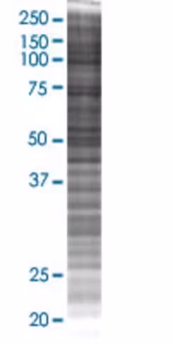Procr 293t cell transient overexpre ssion lysate (denatured) 100 µl