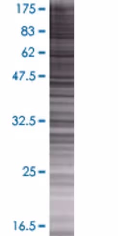 Polr3f 293t cell transient overexpr ession lysate (denatured) 100 µl