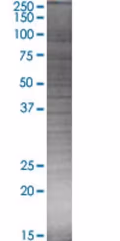 Polr3c 293t cell transient overexpr ession lysate (denatured) 100 µl