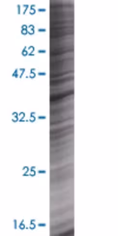 Rad51ap1 293t cell transient overex pression lysate(denatured) 100 µl