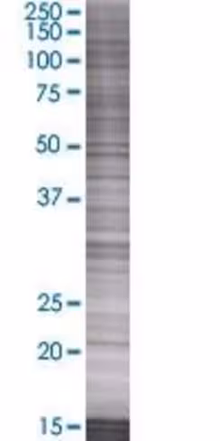 Pmvk 293t cell transient overexpres sion lysate (denatured) 100 µl