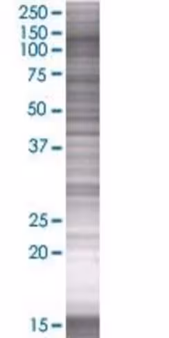 Plk4 293t cell transient overexpres sion lysate (denatured) 100 µl