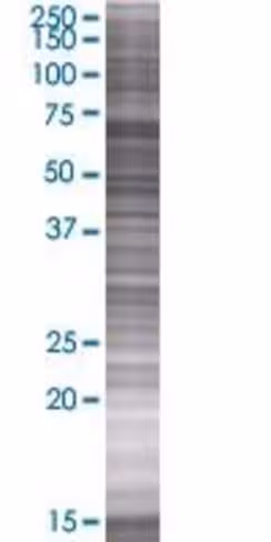 Rai2 293t cell transient overexpres sion lysate (denatured) 100 µl