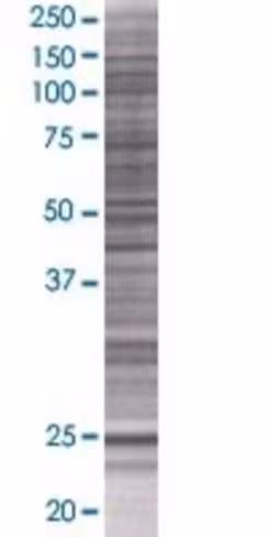 Pttg2 293t cell transient overexpre ssion lysate (denatured) 100 µl