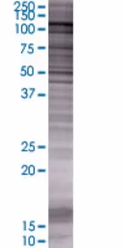 Ppp1r13l 293t cell transient overex pression lysate(denatured) 100 µl