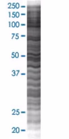 Ralbp1 293t cell transient overexpr ession lysate (denatured) 100 µl