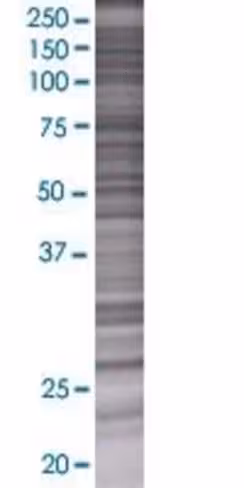 Prdx3 293t cell transient overexpre ssion lysate (denatured) 100 µl
