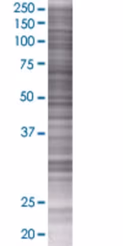 Prss21 293t cell transient overexpr ession lysate (denatured) 100 µl
