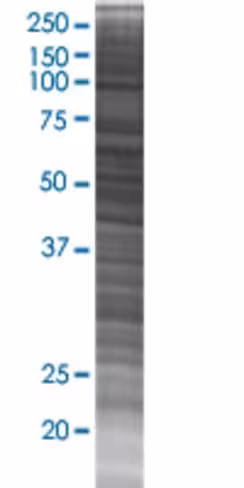 Pdia5 293t cell transient overexpre ssion lysate (denatured) 100 µl