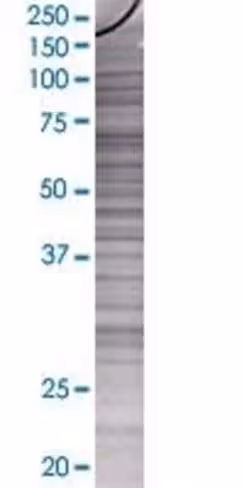 Pols 293t cell transient overexpres sion lysate (denatured) 100 µl