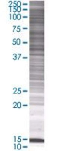 Ate1 293t cell transient overexpres sion lysate (denatured) 100 µl
