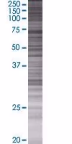 Pwp1 293t cell transient overexpres sion lysate (denatured) 100 µl