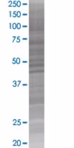 Pwp1 293t cell transient overexpres sion lysate (denatured) 100 µl