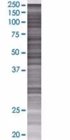 Ptenp1 293t cell transient overexpr ession lysate (denatured) 100 µl
