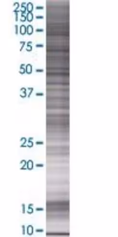 Prosc 293t cell transient overexpre ssion lysate (denatured) 100 µl