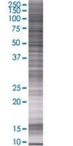 Prosc 293t cell transient overexpre ssion lysate (denatured) 100 µl