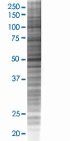 Rassf8 293t cell transient overexpr ession lysate (denatured) 100 µl