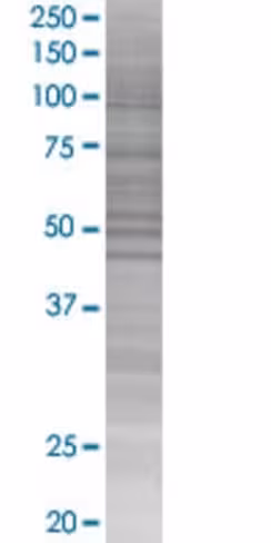 Polg2 293t cell transient overexpre ssion lysate (denatured) 100 µl