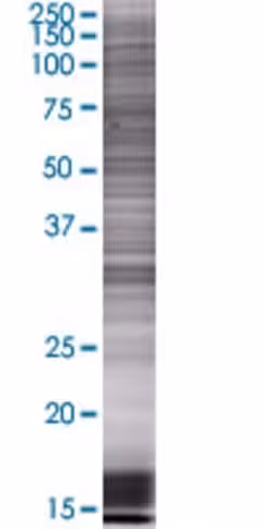 Nxph4 293t cell transient overexpre ssion lysate (denatured) 100 µl