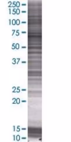 Pacsin2 293t cell transient overexp ression lysate (denatured) 100 µl