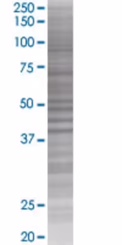 Ptk9l 293t cell transient overexpre ssion lysate (denatured) 100 µl