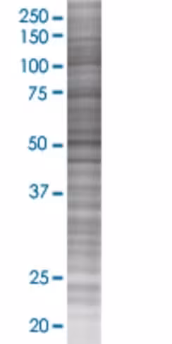 Rasa3 293t cell transient overexpre ssion lysate (denatured) 100 µl
