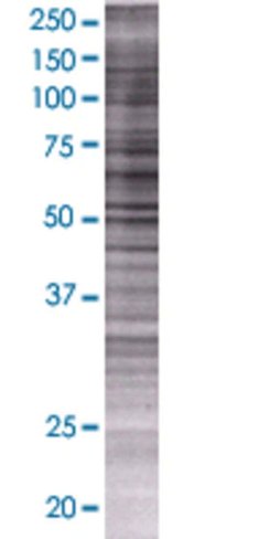 Arsg 293t cell transient overexpres sion lysate (denatured) 100 µl