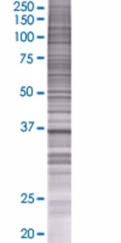 Raly 293t cell transient overexpres sion lysate (denatured) 100 µl