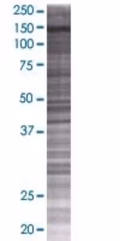 Pdzrn3 293t cell transient overexpr ession lysate (denatured) 100 µl