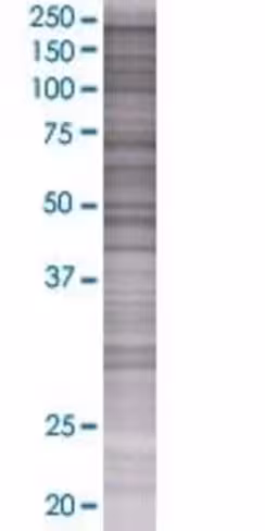 Pogz 293t cell transient overexpres sion lysate (denatured) 100 µl